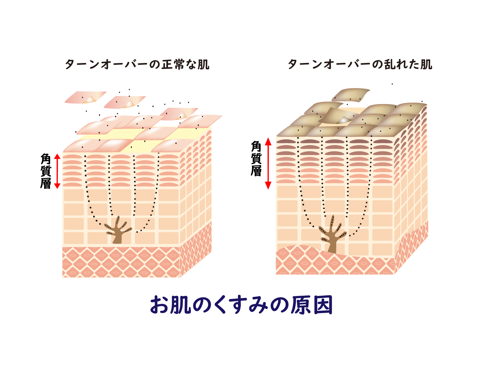 肌のターンオーバー